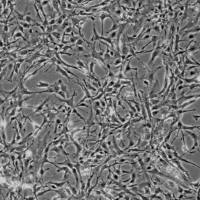 人星形胶质细胞