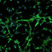 人头皮成纤维细胞-胎儿