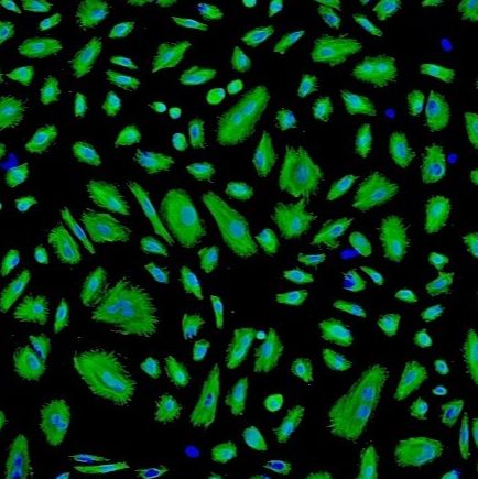 人羊膜上皮细胞