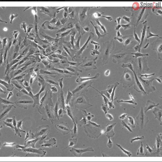 人脉络丛上皮细胞