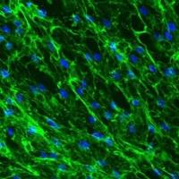 人淋巴成纤维细胞