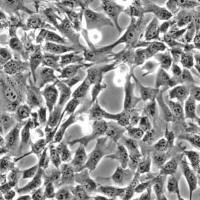 人羊膜间充质基质细胞 HAMSC (Sciencell进口)