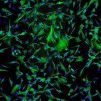 人星形胶质细胞 - 中脑