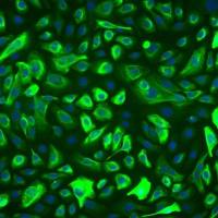 人前列腺上皮细胞