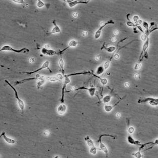 人脑干神经元 HN-bs (Sciencell进口)