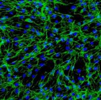 人肠道成纤维细胞
