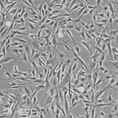 人心脏成纤维细胞--成人心房