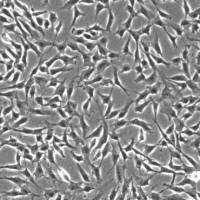 人中耳成纤维细胞