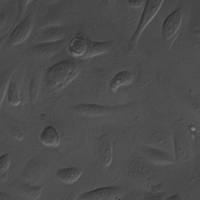 人睾丸间质细胞