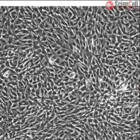 人骨骼肌成肌细胞 HSkMC (Sciencell进口)