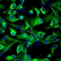 人肾小管上皮细胞