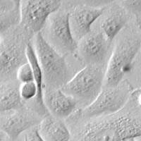 人尿道上皮细胞