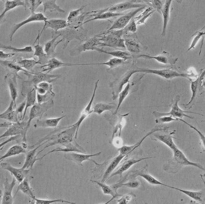 人肾上腺皮质细胞