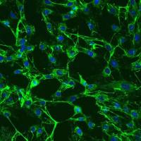 人子宫成纤维细胞