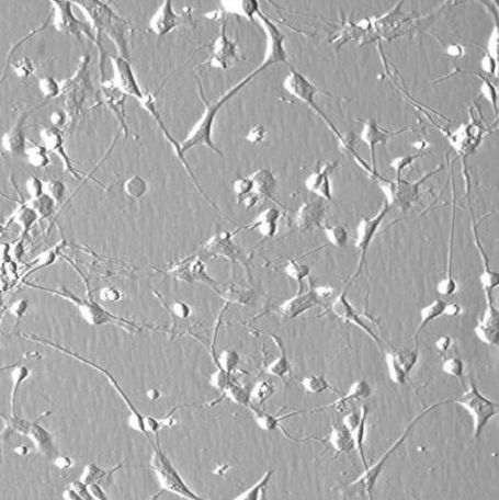 人小脑颗粒细胞