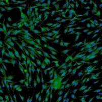 人间充质干细胞-脂肪（Sciencell进口）