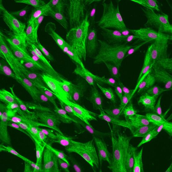 人晶状体上皮细胞