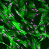 人晶状体上皮细胞