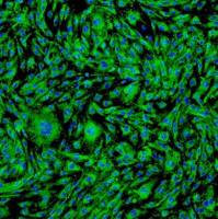 人卵巢微血管内皮细胞