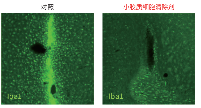 小胶质细胞清除剂