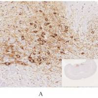 MPTP诱导的帕金森病模型