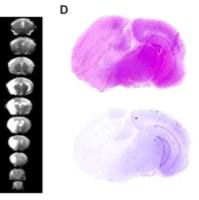 脑缺血后再灌注模型（MCAO）
