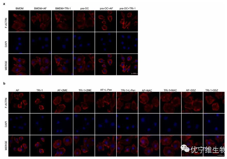 TXNRD1抑制剂诱导的细胞死亡过程中F-actin的收缩情况