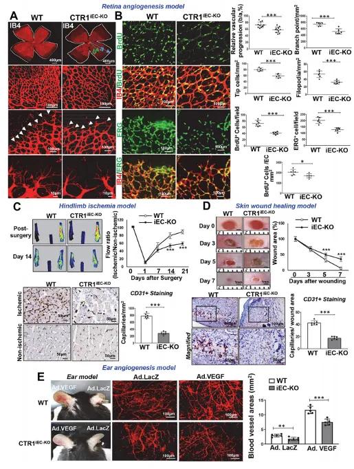 内皮细胞CTR1促进血管生成
