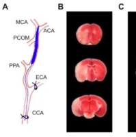 永久性大脑中动脉脑缺血模型（MCAO）