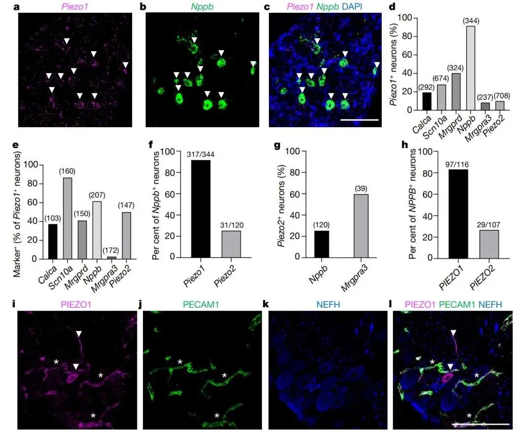 PIEZO1 在小鼠和人类的瘙痒相关受体中表达