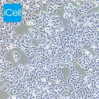 B16细胞 |B-16细胞 | B-16 | B16 | 小鼠黑色素瘤细胞/种属鉴定/镜像绮点
