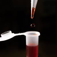 间α抑制剂蛋白（IaIp）-人血浆