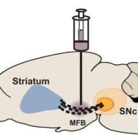 6-羟基多巴胺( 6-OHDA)诱导的帕金森病模型
