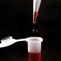 超氧化物歧化酶-人红细胞