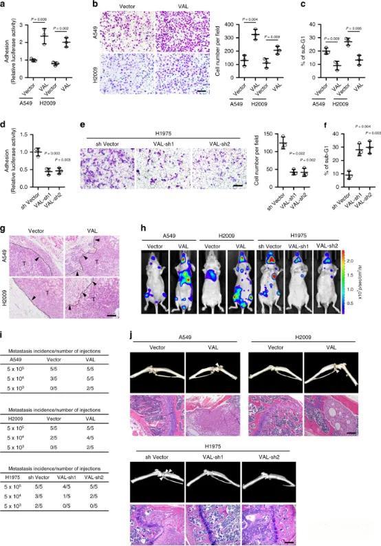 VAL促进肺癌转移和侵袭