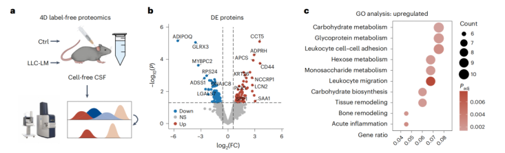 项目文章：《Nature Cancer》首次揭示脑膜转移瘤中巨噬细胞硬脑膜-脑脊液迁移的动态过程及其调控机制