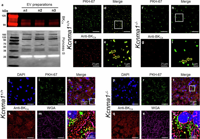 外泌体技术服务 外泌体技术服务