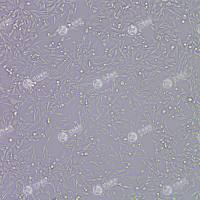 STUB1基因敲除细胞(MB49)
