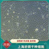 人绒毛膜滋养细胞;HTR-8/Svneo(圻明细胞库ATCC引种代购)