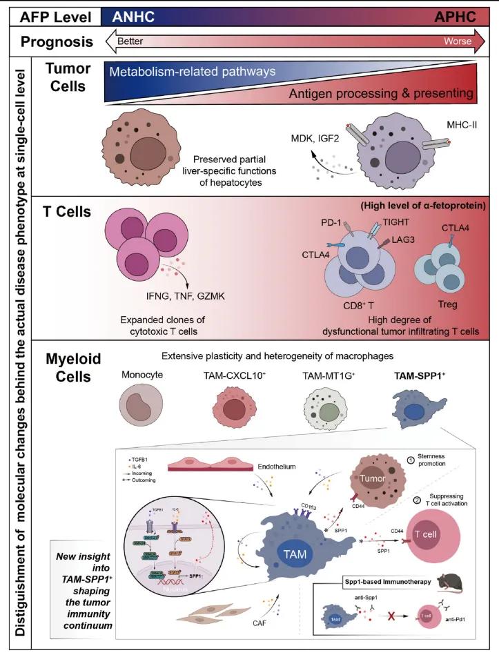 AFP阳性肝细胞癌中的抑制性免疫微环境