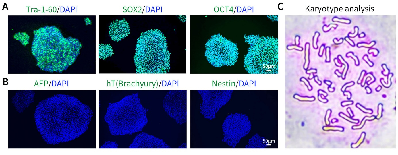BeyoES™人多能干细胞培养液