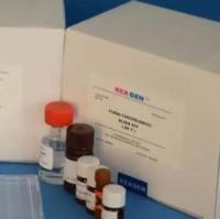 Caspase-1p20天冬氨酸-胱氨酸特异性蛋白酶家族1P20免疫组化试剂盒