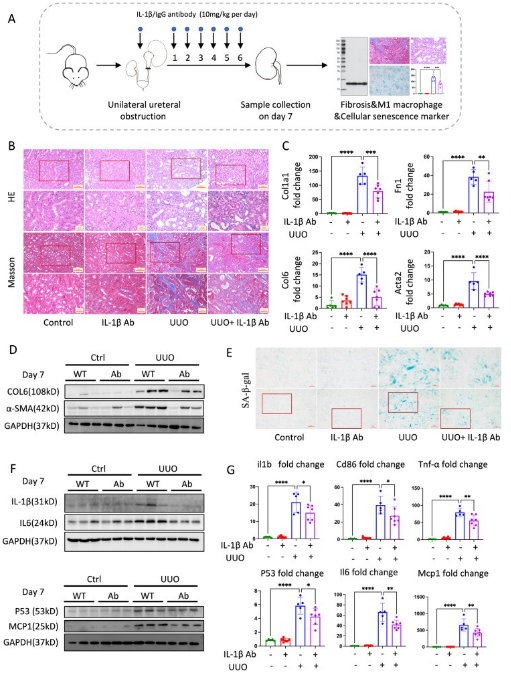 image.png 肾纤维化背后的神秘 “推手” 竟是它?