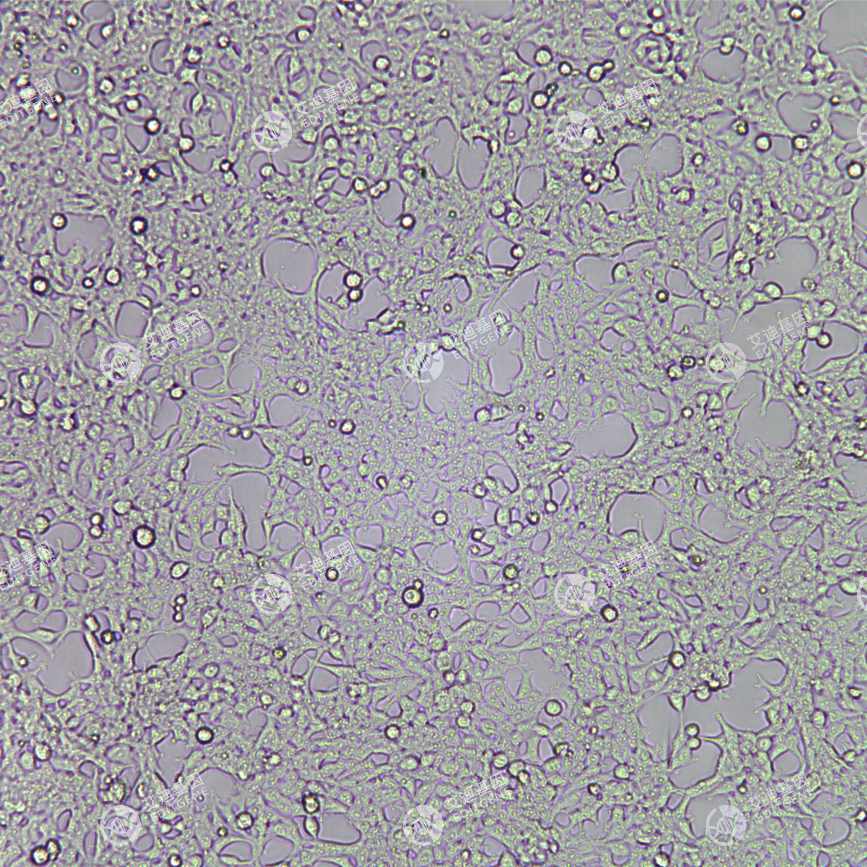 NPC1基因敲除细胞(293T)