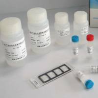 GSE1基因抑制元件1免疫组化试剂盒