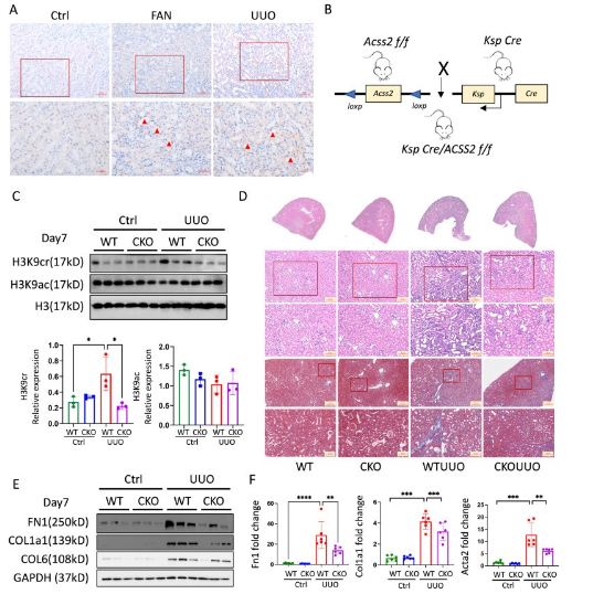 image.png 肾纤维化背后的神秘 “推手” 竟是它?