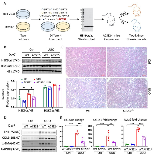 image.png 肾纤维化背后的神秘 “推手” 竟是它?