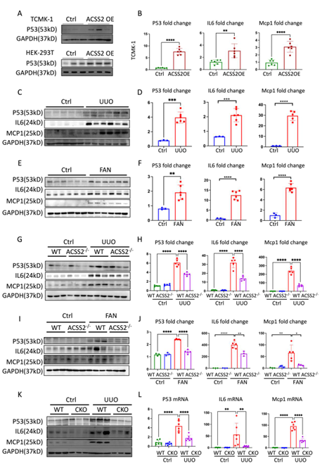 image.png 肾纤维化背后的神秘 “推手” 竟是它?