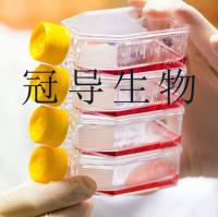 Jurkat, Clone E6-1人T淋巴细胞白血病传代细胞长期复苏|送STR图谱