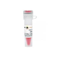 DNA Ladder (0.2-12kb, 12 bands, with BeyoRed)